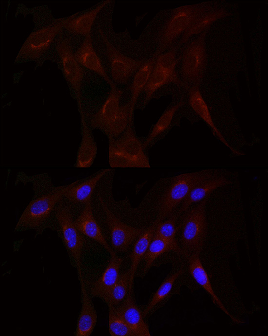 Immunofluorescence analysis of NIH/3T3 cells using LDL Receptor Polyclonal Antibody at dilution of 1:200 (40x lens). Blue: DAPI for nuclear staining.