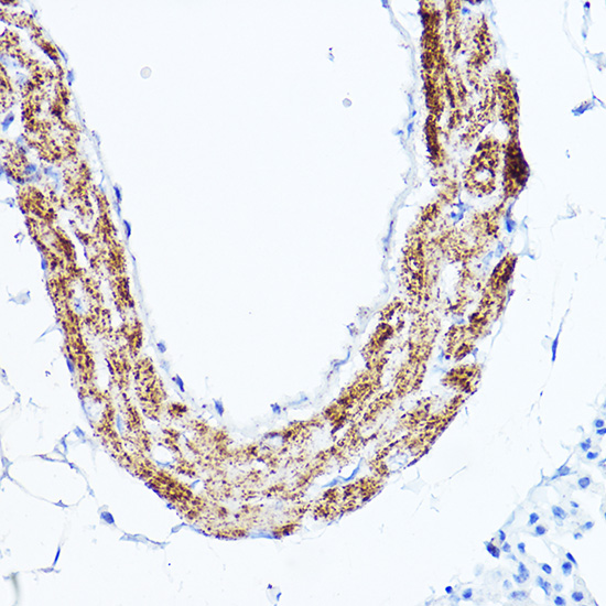 Immunohistochemistry of paraffin-embedded Mouse lung using LDL Receptor Polyclonal Antibody at dilution of 1:100 (40x lens).Perform high pressure antigen retrieval with 10 mM citrate buffer pH 6.0 before commencing with IHC staining protocol.