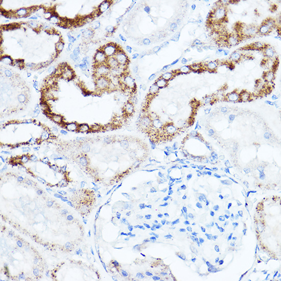 Immunohistochemistry of paraffin-embedded Rat kidney using LDL Receptor Polyclonal Antibody at dilution of 1:100 (40x lens).Perform high pressure antigen retrieval with 10 mM citrate buffer pH 6.0 before commencing with IHC staining protocol.