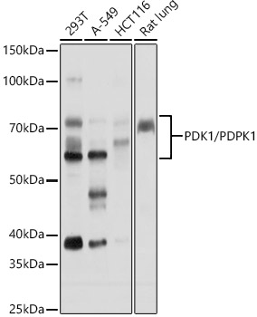 Western blot analysis of extracts of various cell lines using PDK1/PDPK1 Polyclonal Antibody at 1:5000 dilution.