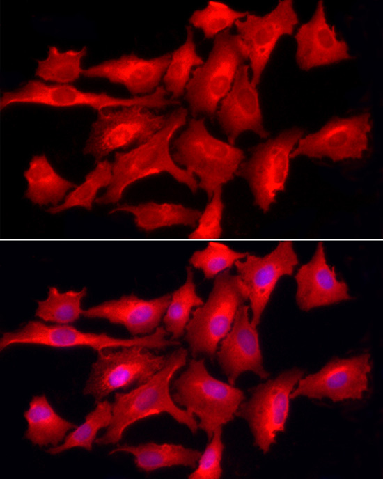 Immunofluorescence analysis of A-549 cells using [KO Validated] PTPN2 Polyclonal Antibody at dilution of 1:200 (40x lens). Blue: DAPI for nuclear staining.