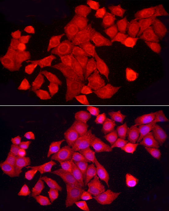 Immunofluorescence analysis of HeLa cells using [KO Validated] PTPN2 Polyclonal Antibody at dilution of 1:200 (40x lens). Blue: DAPI for nuclear staining.