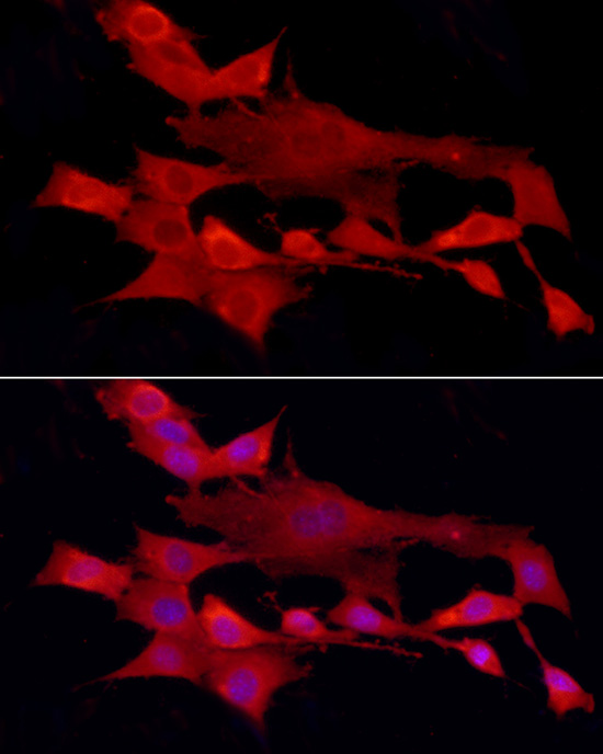 Immunofluorescence analysis of NIH/3T3 cells using [KO Validated] PTPN2 Polyclonal Antibody at dilution of 1:200 (40x lens). Blue: DAPI for nuclear staining.