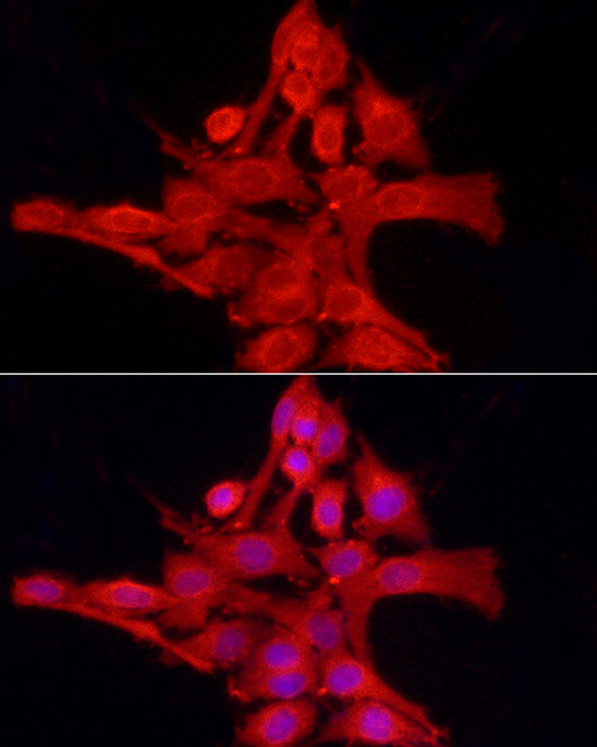 Immunofluorescence analysis of PC-12 cells using [KO Validated] PTPN2 Polyclonal Antibody at dilution of 1:200 (40x lens). Blue: DAPI for nuclear staining.