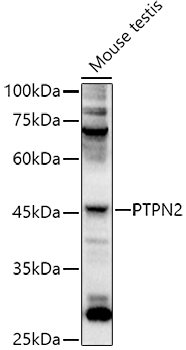 Western blot analysis of extracts of Mouse testis using PTPN2 Polyclonal Antibody at 1:1000 dilution.