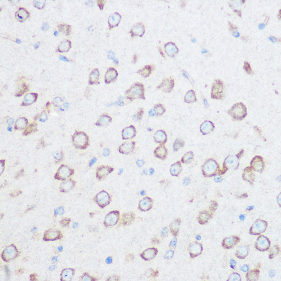 Immunohistochemistry of paraffin-embedded Mouse brain using NG2/CSPG4 Polyclonal Antibody at dilution of 1:100 (40x lens).Perform microwave antigen retrieval with 10 mM Tris/EDTA buffer pH 9.0 before commencing with IHC staining protocol.