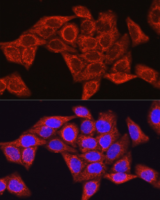 Immunofluorescence analysis of HeLa cells using [KO Validated] Glutamine Synthetase Polyclonal Antibodyat dilution of 1:100 (40x lens). Blue: DAPI for nuclear staining.