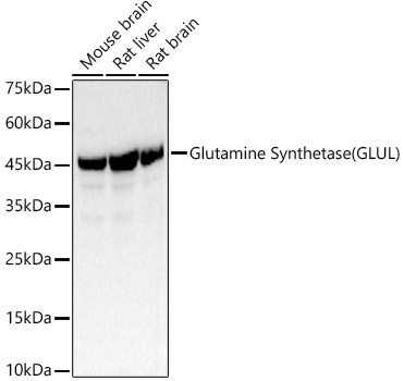 Western blot analysis of various lysates using Glutamine Synthetase Polyclonal Antibody at 1:400 dilution.