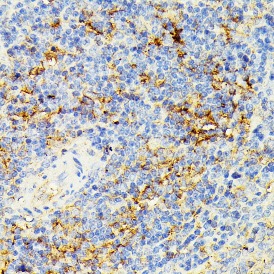 Immunohistochemistry of paraffin-embedded rat spleen using ECE1 Polyclonal Antibody at dilution of 1:100 (40x lens).Perform microwave antigen retrieval with 10 mM PBS buffer pH 7.2 before commencing with IHC staining protocol.
