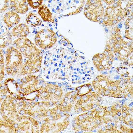 Immunohistochemistry of paraffin-embedded mouse kidney using ECE1 Polyclonal Antibody at dilution of 1:100 (40x lens).Perform microwave antigen retrieval with 10 mM PBS buffer pH 7.2 before commencing with IHC staining protocol.