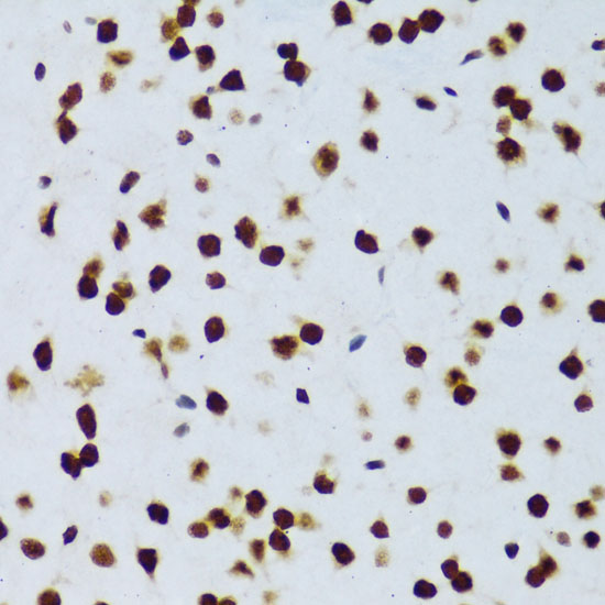 Immunohistochemistry of paraffin-embedded mouse brain using FUS Polyclonal Antibody at dilution of 1:100 (40x lens).Perform microwave antigen retrieval with 10 mM PBS buffer pH 7.2 before commencing with IHC staining protocol.