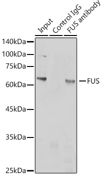 Immunoprecipitation analysis of 300ug extracts of Jurkat cells using 3ug FUS Polyclonal Antibody. Western blot was performed from the immunoprecipitate using FUS Polyclonal Antibody at a dilution of 1:1000.