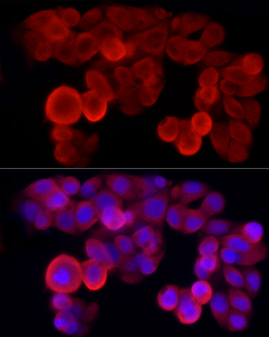 Immunofluorescence analysis of HepG2 cells using NLRP3 Polyclonal Antibody at dilution of 1:50 (40x lens). Blue: DAPI for nuclear staining.