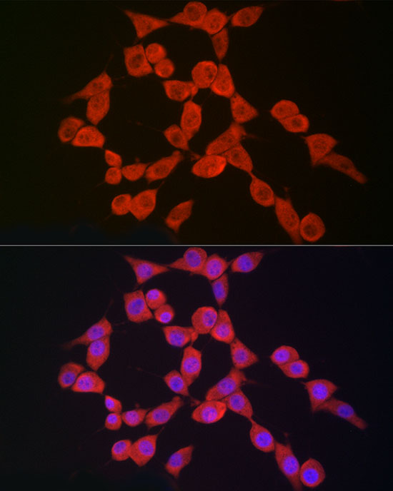 Immunofluorescence analysis of NIH/3T3 cells using NLRP3 Polyclonal Antibody at dilution of 1:50 (40x lens). Blue: DAPI for nuclear staining.