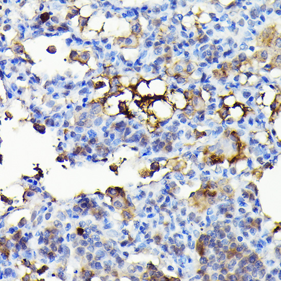 Immunohistochemistry of paraffin-embedded rat lung using NADPH oxidase 4 Polyclonal Antibody at dilution of 1:100 (40x lens).Perform high pressure antigen retrieval with 10 mM citrate buffer pH 6.0 before commencing with IHC staining protocol.