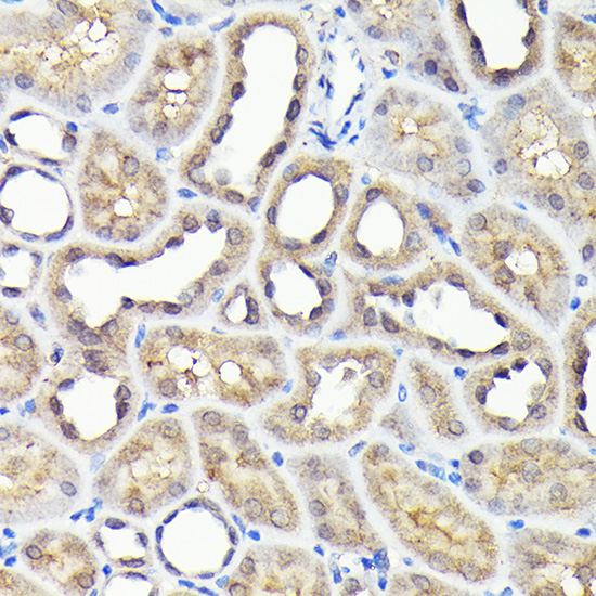 Immunohistochemistry of paraffin-embedded rat kidney using NADPH oxidase 4 Polyclonal Antibody at dilution of 1:100 (40x lens).Perform high pressure antigen retrieval with 10 mM citrate buffer pH 6.0 before commencing with IHC staining protocol.