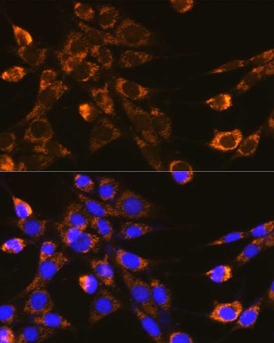 Immunofluorescence analysis of NIH-3T3 cells using Integrin-β1/CD29 Polyclonal Antibody at dilution of 1:100 (40x lens). Blue: DAPI for nuclear staining.