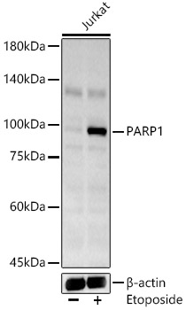 Western blot analysis of Jurkat using Cleaved PARP Polyclonal Antibody at 1:1000 dilution.Jurkat cells were treated by Etoposide (25 uM) at 37℃ for 5 hours.