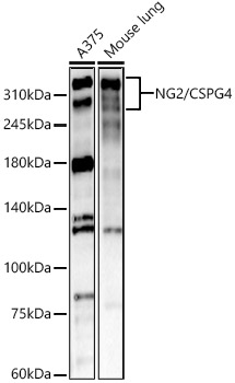 Western blot analysis of various lysates using NG2/CSPG4 Polyclonal Antibody at 1:1500 dilution.