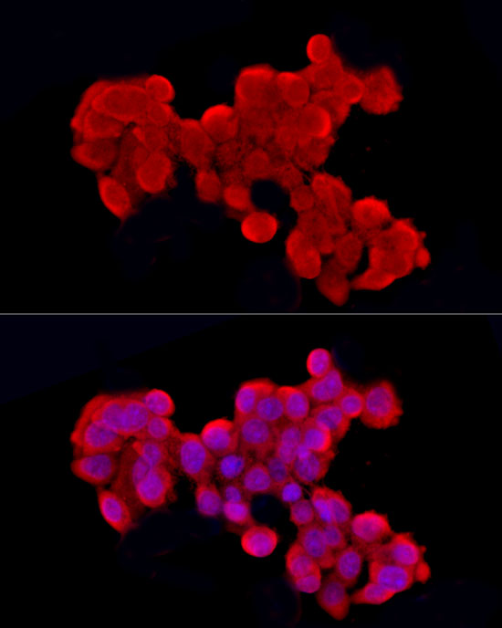 Immunofluorescence analysis of HepG2 cells using Cleaved Caspase-9 P37 Polyclonal Antibody at dilution of 1:50 (40x lens). Blue: DAPI for nuclear staining.