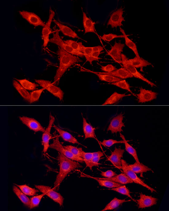 Immunofluorescence analysis of PC-12 cells using Cleaved Caspase-9 P37 Polyclonal Antibody at dilution of 1:50 (40x lens). Blue: DAPI for nuclear staining.