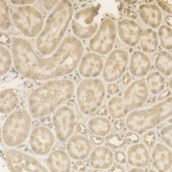 Immunohistochemistry of paraffin-embedded rat kidney using Cleaved Caspase-9 P37 Polyclonal Antibody at dilution of 1:50 (40x lens).Perform high pressure antigen retrieval with 10 mM citrate buffer pH 6.0 before commencing with IHC staining protocol.