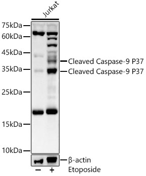 Western blot analysis of extracts of Jurkat using Cleaved Caspase-9 P37 Polyclonal Antibody at 1:1000 dilution.Jurkat cells were treated by Etoposide (25 uM) at 37℃ for 5 hours.