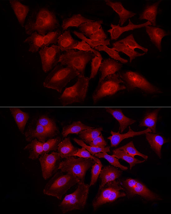 Immunofluorescence analysis of HeLa cells using RELA Polyclonal Antibody at dilution of 1:100 (40x lens). Blue: DAPI for nuclear staining.
