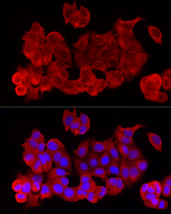 Immunofluorescence analysis of MCF7 cells using RELA Polyclonal Antibody at dilution of 1:100 (40x lens). Blue: DAPI for nuclear staining.