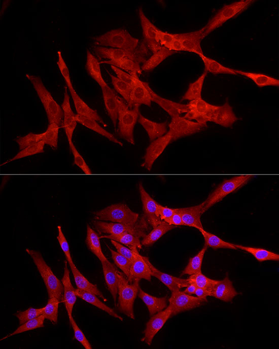 Immunofluorescence analysis of NIH/3T3 cells using RELA Polyclonal Antibody at dilution of 1:100 (40x lens). Blue: DAPI for nuclear staining.