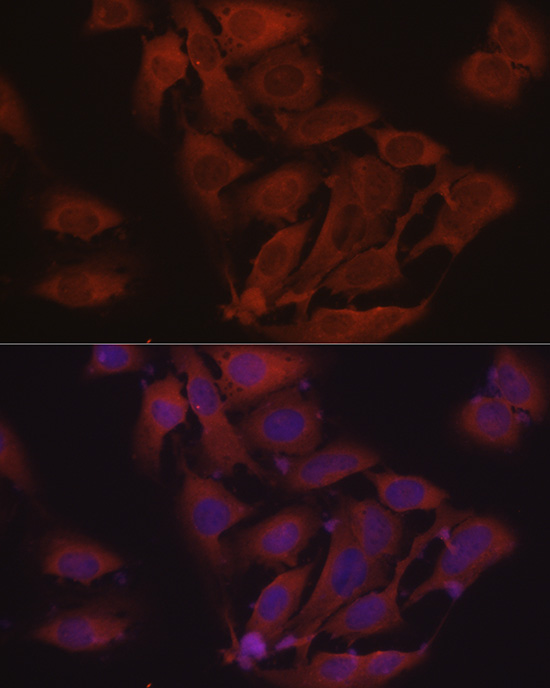 Immunofluorescence analysis of HeLa cells using [KD Validated] eIF4E Polyclonal Antibody at dilution of 1:50 (40x lens). Blue: DAPI for nuclear staining.