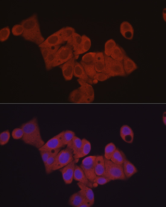 Immunofluorescence analysis of HepG2 cells using [KD Validated] eIF4E Polyclonal Antibody at dilution of 1:50 (40x lens). Blue: DAPI for nuclear staining.