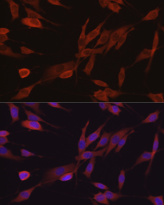 Immunofluorescence analysis of NIH/3T3 cells using [KD Validated] eIF4E Polyclonal Antibody at dilution of 1:50 (40x lens). Blue: DAPI for nuclear staining