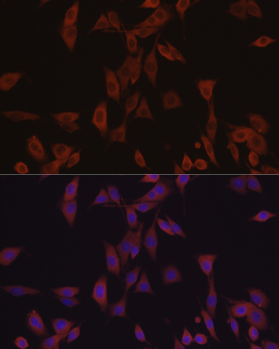 Immunofluorescence analysis of PC-12 cells using [KD Validated] eIF4E Polyclonal Antibody at dilution of 1:50 (40x lens). Blue: DAPI for nuclear staining.