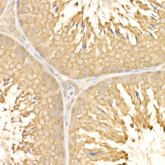 Immunohistochemistry of paraffin-embedded Rat testis using EIF4E Polyclonal Antibody at dilution of 1:50 (40x lens).Perform high pressure antigen retrieval with 10 mM citrate buffer pH 6.0 before commencing with IHC staining protocol.