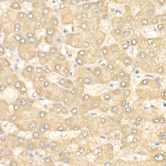 Immunohistochemistry of paraffin-embedded Human liver using EIF4E Polyclonal Antibody at dilution of 1:50 (40x lens).Perform high pressure antigen retrieval with 10 mM citrate buffer pH 6.0 before commencing with IHC staining protocol.