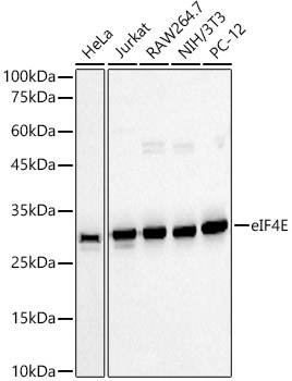 Western blot analysis of extracts from wild type(WT) and eIF4E knockdown (KD) 293T(KD) cells, using eIF4E Polyclonal Antibody at 1:500 dilution