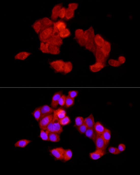 Immunofluorescence analysis of HepG2 cells using [KO Validated] NF-kB p65/RelA Polyclonal Antibody at dilution of 1:200 (40x lens). Blue: DAPI for nuclear staining.