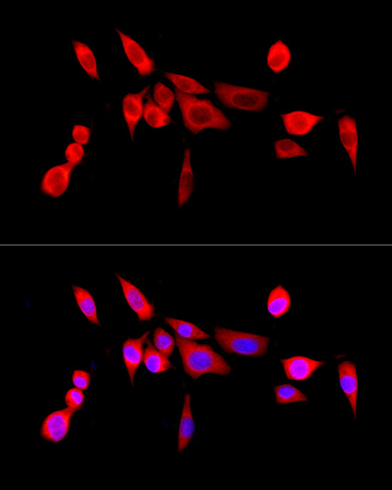 Immunofluorescence analysis of NIH/3T3 cells using [KO Validated] NF-kB p65/RelA Polyclonal Antibody at dilution of 1:200 (40x lens). Blue: DAPI for nuclear staining.