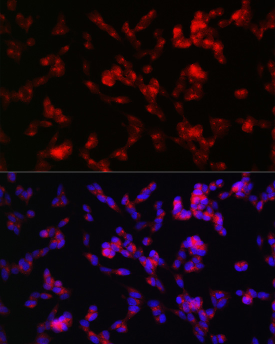 Immunofluorescence analysis of SH-SY5Y cells using ADAMTS4 Polyclonal Antibody at dilution of 1:100 (40x lens). Blue: DAPI for nuclear staining.