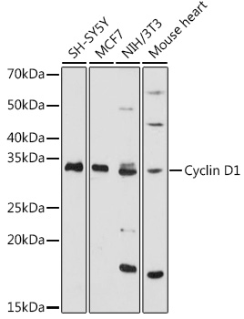 Western blot analysis of extracts of various cell lines using Cyclin D1 Polyclonal Antibody at 1:1000 dilution.