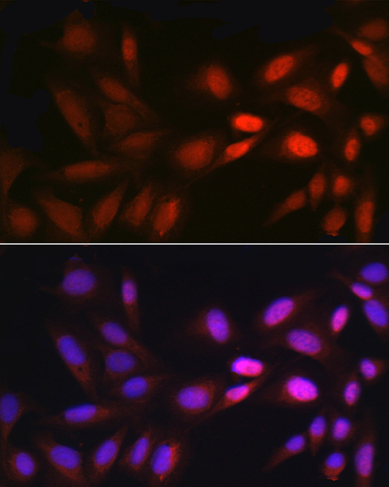 Immunofluorescence analysis of U2OS cells using EGR1 Polyclonal Antibody at dilution of 1:200 (40x lens). Blue: DAPI for nuclear staining.