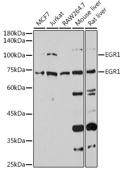 Western blot analysis of extracts of various cell lines using EGR1 Polyclonal Antibody at 1:1000 dilution.