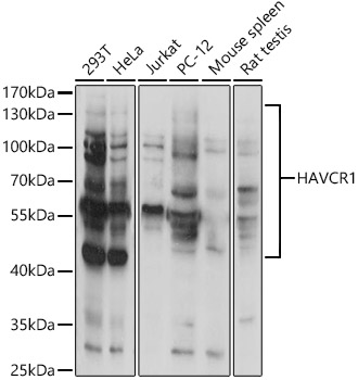 Western blot analysis of extracts of various cell lines using HAVCR1 Polyclonal Antibody at 1:1000 dilution.