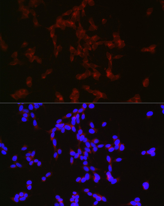 Immunofluorescence analysis of SH-SY5Y cells using NPY Polyclonal Antibody at dilution of 1:50 (40x lens). Blue: DAPI for nuclear staining.