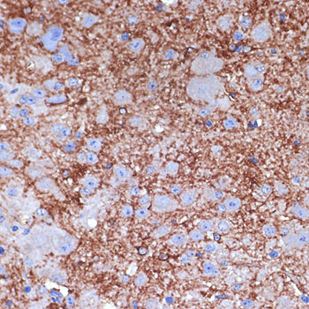 Immunohistochemistry of paraffin-embedded mouse spinal cord using NPY Polyclonal Antibody at dilution of 1:100 (40x lens).Perform microwave antigen retrieval with 10 mM Tris/EDTA buffer pH 9.0 before commencing with IHC staining protocol.