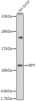 Western blot analysis of extracts of SH-SY5Y cells using NPY Polyclonal Antibody at 1:1000 dilution.