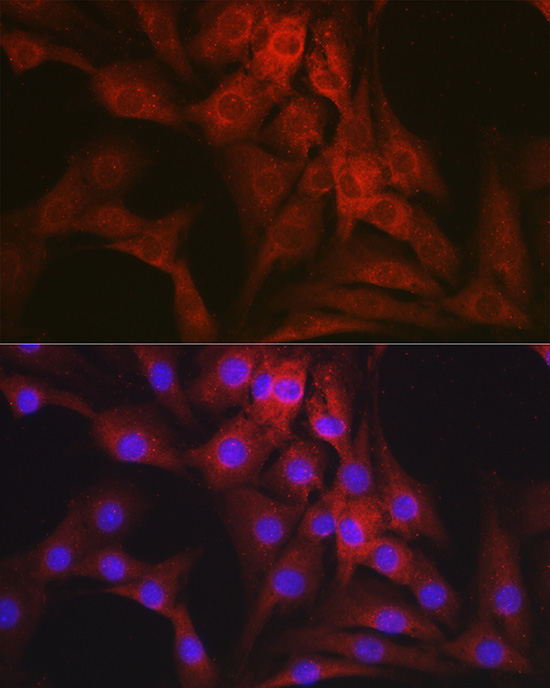 Immunofluorescence analysis of NIH-3T3 cells using Mineralocorticoid receptor Polyclonal Antibody at dilution of 1:100 (40x lens). Blue: DAPI for nuclear staining.