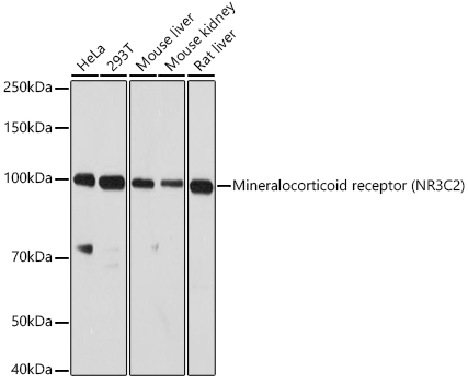 Western blot analysis of extracts of various cell lines using Mineralocorticoid receptor Polyclonal Antibody at 1:1000 dilution.