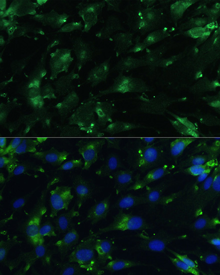 Immunofluorescence analysis of C6 cells using CGRP Polyclonal Antibody at dilution of 1:100. Blue: DAPI for nuclear staining.